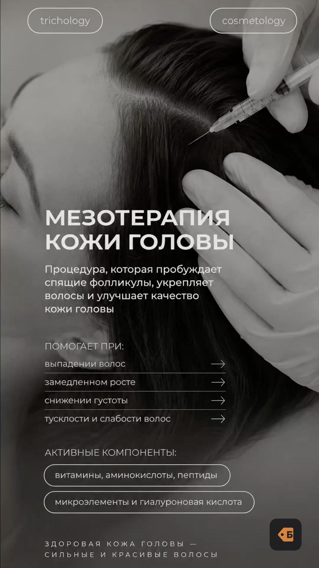 Мезотерапия волос 